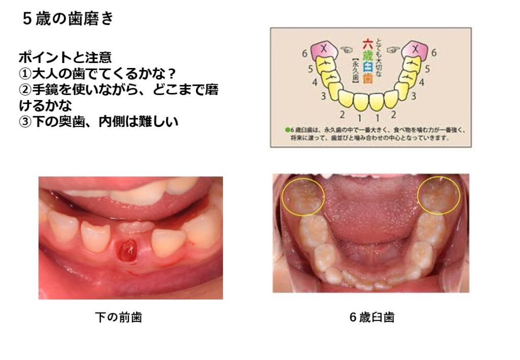 子どもの歯ブラシ⑤ 5才の子 | 鈴木歯科医院