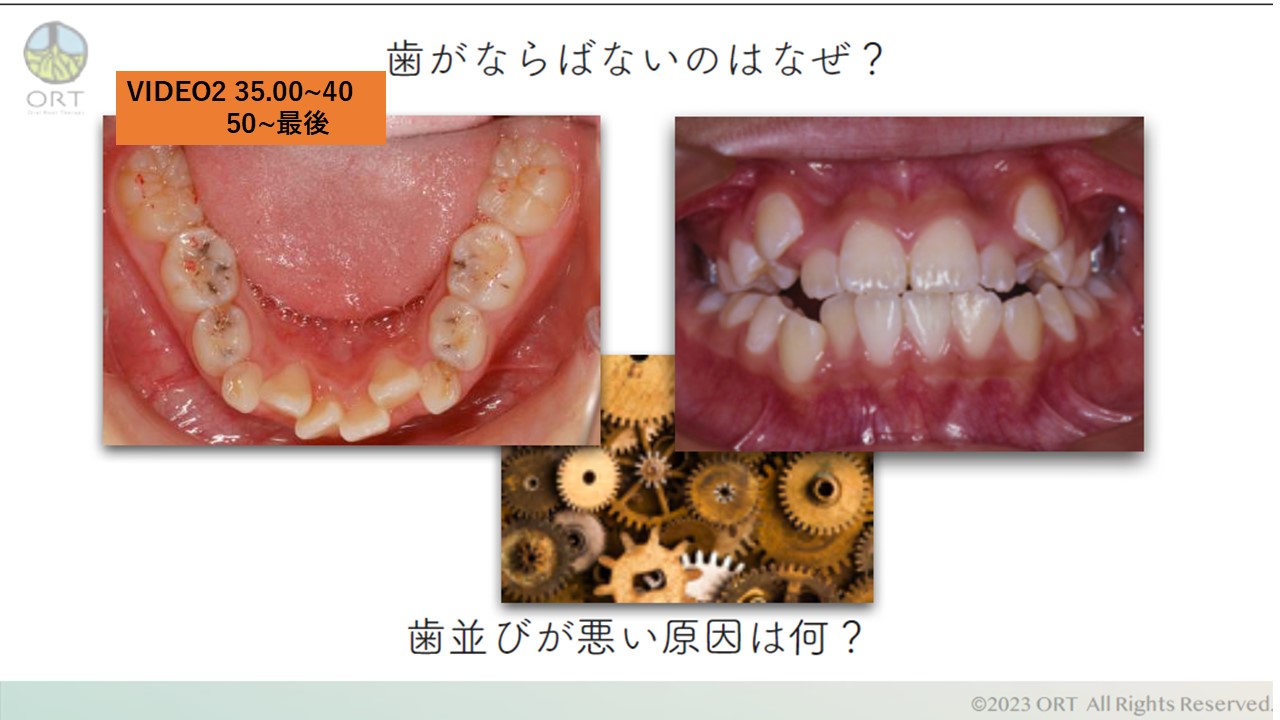 続編！鈴木歯科院長コメント！口腔機能発達不全症セミナーを受けて